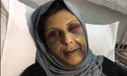 Bahraini man who assaulted ex-wife to be produced before court Bahraini man who assaulted ex-wife to be produced before court