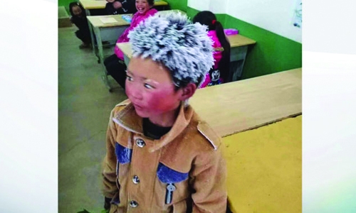 Chinese boy with frozen hair reignites poverty debate