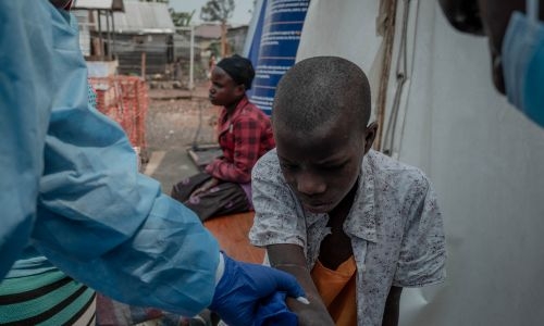 First mpox case reported in Pakistan; Europe warned to prepare for virus spread