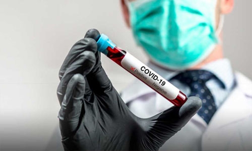 Global COVID-19 caseload surpasses 121.49 million; death toll 2,810,880