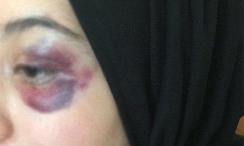 Bahraini wife face husband's wrath