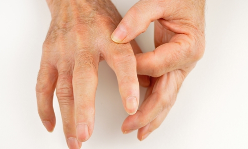 Man refuses to pay BD3, breaks taxi driver finger