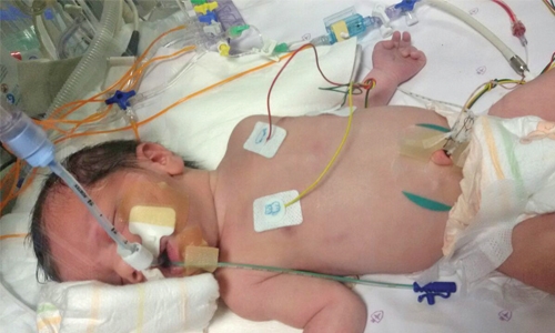 Newborn child with heart defect seeks financial aid
