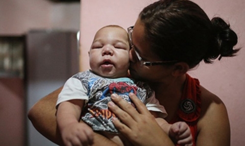 Women infected with Zika should continue to breastfeed: WHO