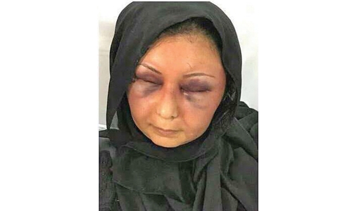 Woman describes brutal  attack, Bahraini husband arrested