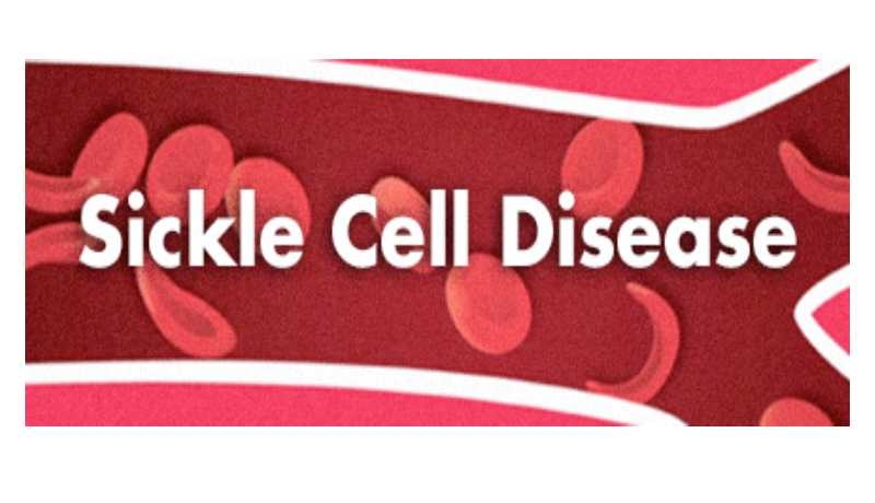 Plea to end plight of female sickle cell patients, most female SCD patients made to wait for over eight hours before seeing a doctor 