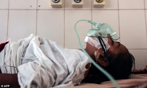 'Scared' father of Bangladesh 'tree girl' ends treatment 'Scared' father of Bangladesh 'tree girl' ends treatment