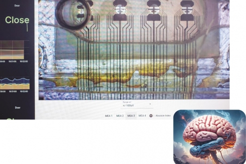 Scientists explore “wetware” using human mini-brains to power computers Scientists explore “wetware” using human mini-brains to power computers