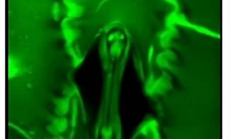 How do Plants Breathe?