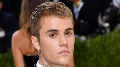  Justin Bieber reveals facial paralysis after rare virus attack, cancels shows