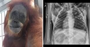 Orangutan recovers after shot with 74 airgun pellets Orangutan recovers after shot with 74 airgun pellets