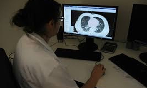 Drug gives lung cancer patients four extra months