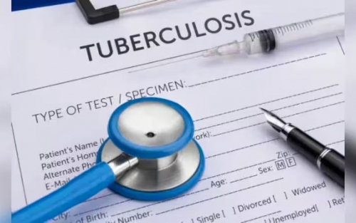 Potential new TB vaccines could save millions of lives: Gavi Potential new TB vaccines could save millions of lives: Gavi