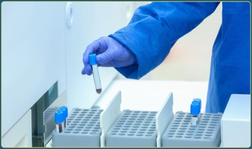 KFSHRC Achieves Breakthrough in Gene Therapy with Local Production of CAR-T Cells KFSHRC Achieves Breakthrough in Gene Therapy with Local Production of CAR-T Cells