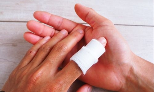 Asian man jailed for severing garage worker’s fingers
