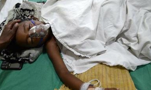 Father drops son on red-hot coal during ritual