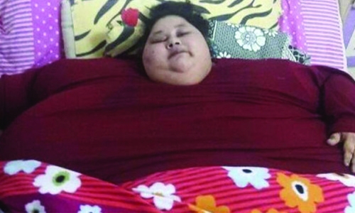 500kg Egyptian sheds half her weight after India surgery