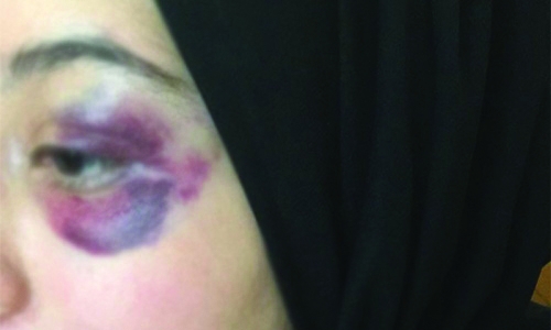 Jail for Bahraini man who brutally beat up his wife on road