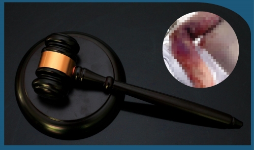 Bahraini Man, Nephew Ordered to Pay BD 50,000 for Severe Burn Injuries