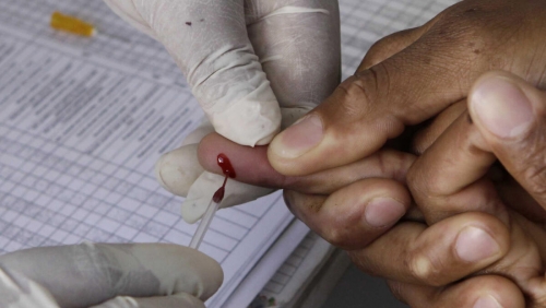 Man becomes third patient to be cured of HIV after stem cell transplant