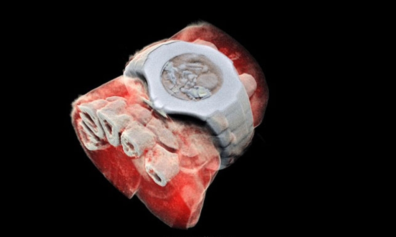 First-ever colour X-ray on a human performed in New Zealand
