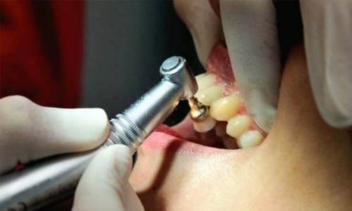 8 years jail sought for ‘dentist of horror’ 8 years jail sought for ‘dentist of horror’