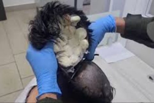 Colombian Man Caught Smuggling Cocaine Capsules Under Toupee at Cartagena Airport Colombian Man Caught Smuggling Cocaine Capsules Under Toupee at Cartagena Airport
