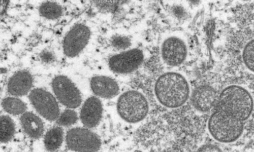 Rare monkeypox outbreaks detected in North America, Europe