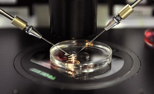 Spanish scientists use skin cells to create human sperm Spanish scientists use skin cells to create human sperm