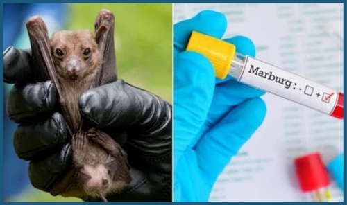 Marburg in Ethiopia: A Deadly Mystery Unfolding Marburg in Ethiopia: A Deadly Mystery Unfolding