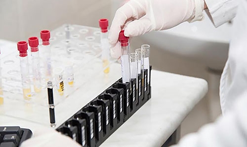 Russia says its Ebola vaccine 'effective' in initial tests