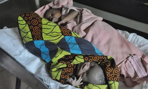 Study highlights high death risk for Africa twins Study highlights high death risk for Africa twins