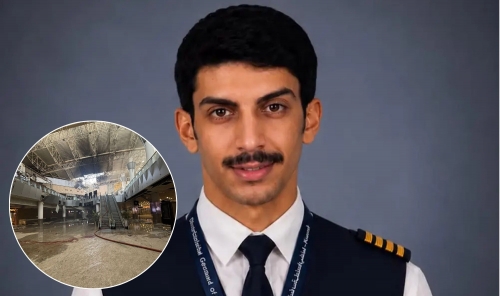 Kuwait Airport Security Officer Loses Leg in Brutal Attack