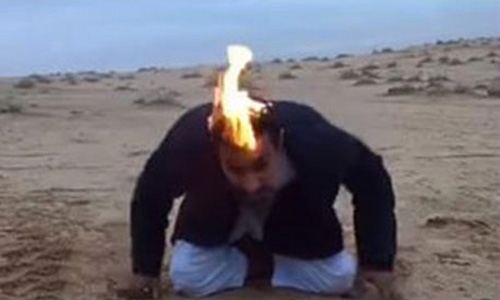 Saudi sets hair on fire Saudi sets hair on fire