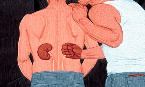 Saudi warns kidney patients against organ traders Saudi warns kidney patients against organ traders