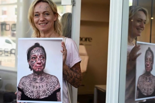 Dutch Charity Helps Abuse Survivors Erase Forced Tattoos and Rebuild Their Lives