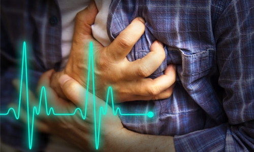 Stents no better than drugs for many heart patients - US study Stents no better than drugs for many heart patients - US study